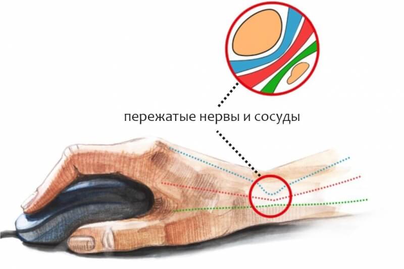 Ссылки на кракен блэкспрут